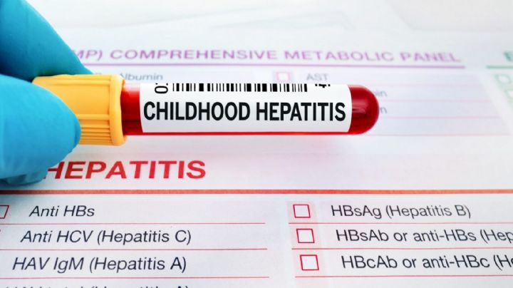 Hepatitis aguda infantil podrÃ­a ser causada por infecciÃ³n en personas que tuvieron Covid-19: INP