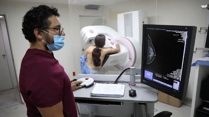 Utilizan Inteligencia Artificial para detectar cáncer de mama