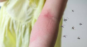 3 métodos para prevenir las picaduras de mosquito a la hora de dormir