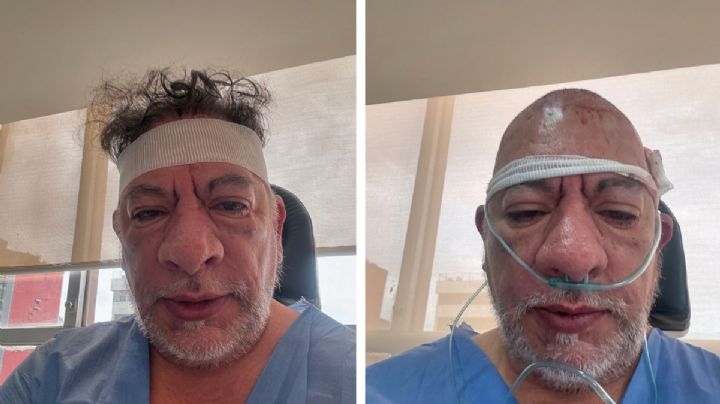 Carlos Trejo reaparece con oxígeno y vendas en la cabeza, ¿por qué fue hospitalizado y sometido a cirugía?