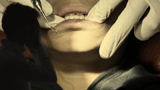 Por una muela picada, un hombre tiene un desenlace fatal al ser inyectado en el dentista