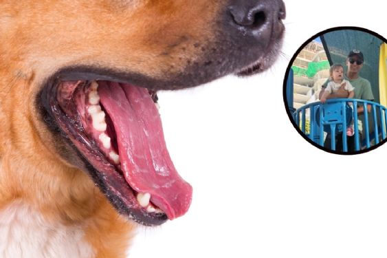 Foto de: Niña de 1 año casi pierde el ojo tras ser atacada por un perro en un parque de Miami: IMÁGENES FUERTES