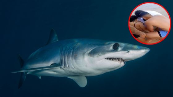 Dos ataques de tiburón en menos de 24 horas dejan a un niño y una joven mutilados de la pierna: VIDEO
