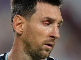¿Qué le pasó a Messi en el ojo? Lesión sangrienta preocupa a los aficionados tras su pase a las semifinales del Mundial
