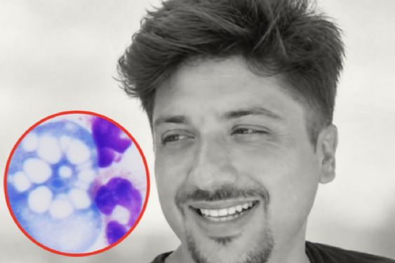 Foto de: Viene multa millonaria por lago contaminado con “ameba comecerebros” en Yucatán